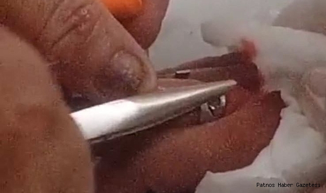 Parmağına yüzük sıkışan çocuk hastanelik oldu..!