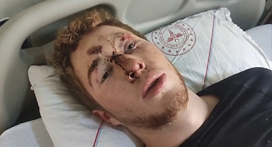 Ağrı Dağı'nda yaralanan Ukraynalı dağcı: "Türkler bana yardım etti"(videolu Haber)