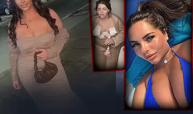 Meme dikleştirme ameliyatı için Türkiye'ye geldi, hayatı kabusa döndü! Arkadaşları meme uçlarının görüntülerini paylaştı