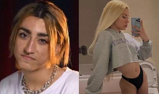 Mika Raun kestirdi mi? Mika Raun kimdir? Mika Raun hangi estetikleri yaptırdı?