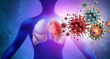 X hastalığı nedir? Nasıl bulaşır