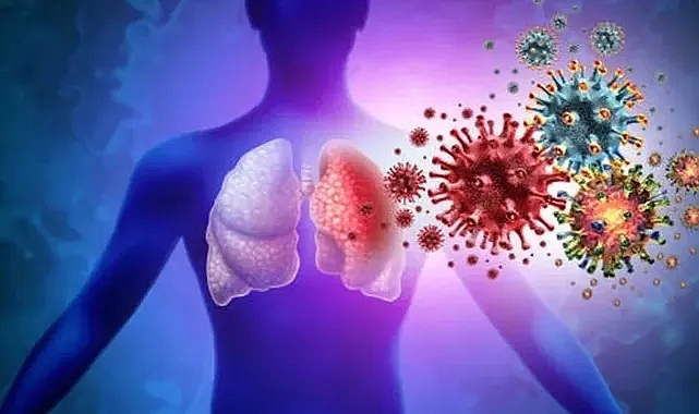 X hastalığı nedir? Nasıl bulaşır
