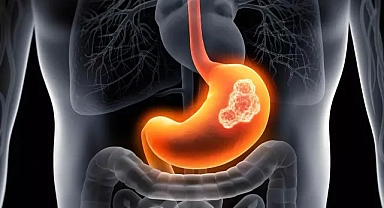 Mide Nedir? Midenin Görevleri