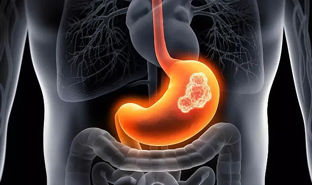 Mide Nedir? Midenin Görevleri