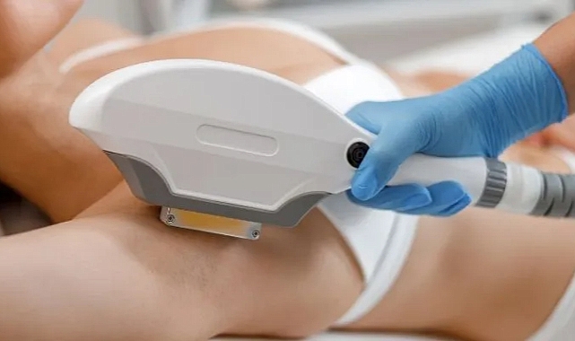 Bim Buz Başlıklı IPL Lazer Epilasyon Cihazı: Kullanıcı Yorumları ve İnceleme
