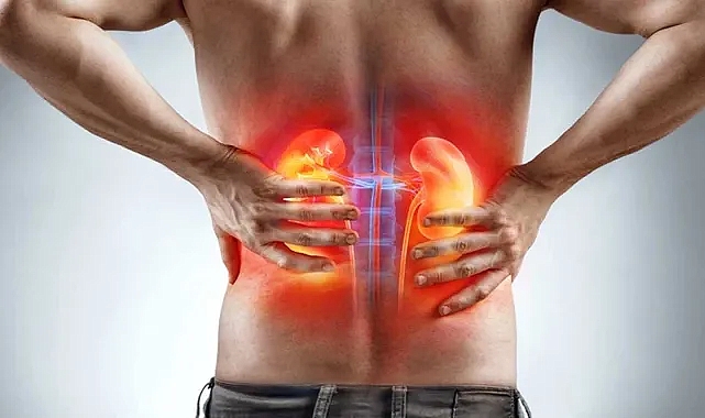Böbrek hastalığının ilerlemesini önleyecek 10 öneri