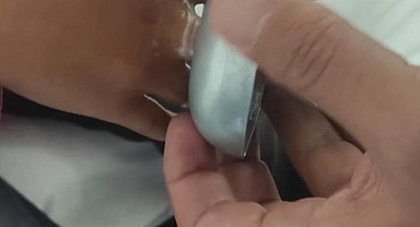 Muş'ta parmağını kapağa sıkıştıran çocuğa  AFAD ekipleri yetişti