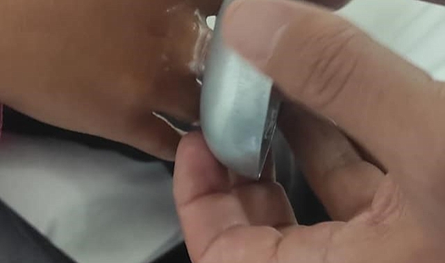 Muş'ta parmağını kapağa sıkıştıran çocuğa  AFAD ekipleri yetişti