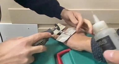 Parmağa sıkışan yüzüğü itfaiye keserek çıkardı