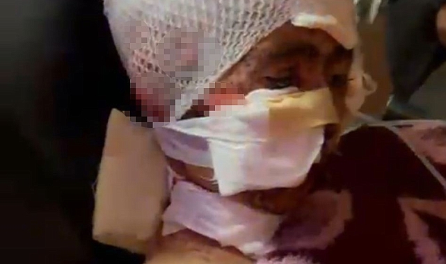 Erzurum'da köpek saldırısına uğrayan çocuğun babası feryat etti: "Bu işe bir çözüm bulun. Artık anne ve babalar gözyaşı dökmesin"