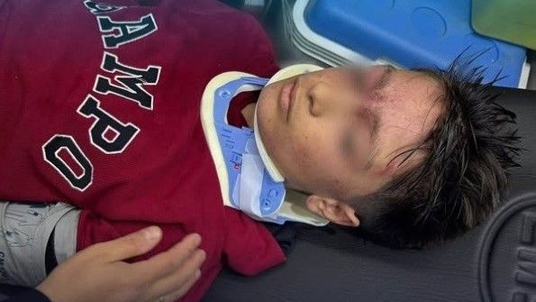 Okul çıkışı merdivenlerde izdiham: 23 öğrenci yaralandı