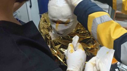 Erzincan’da kömür ocağında yangın: 2 işçi yaralı