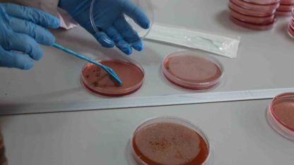 Çiğ süt, gıdayla bulaşan idrar yolu enfeksiyonlarına kapı açıyor