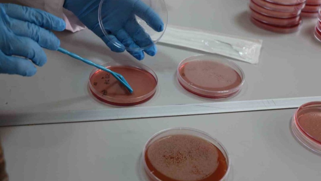 Çiğ süt, gıdayla bulaşan idrar yolu enfeksiyonlarına kapı açıyor