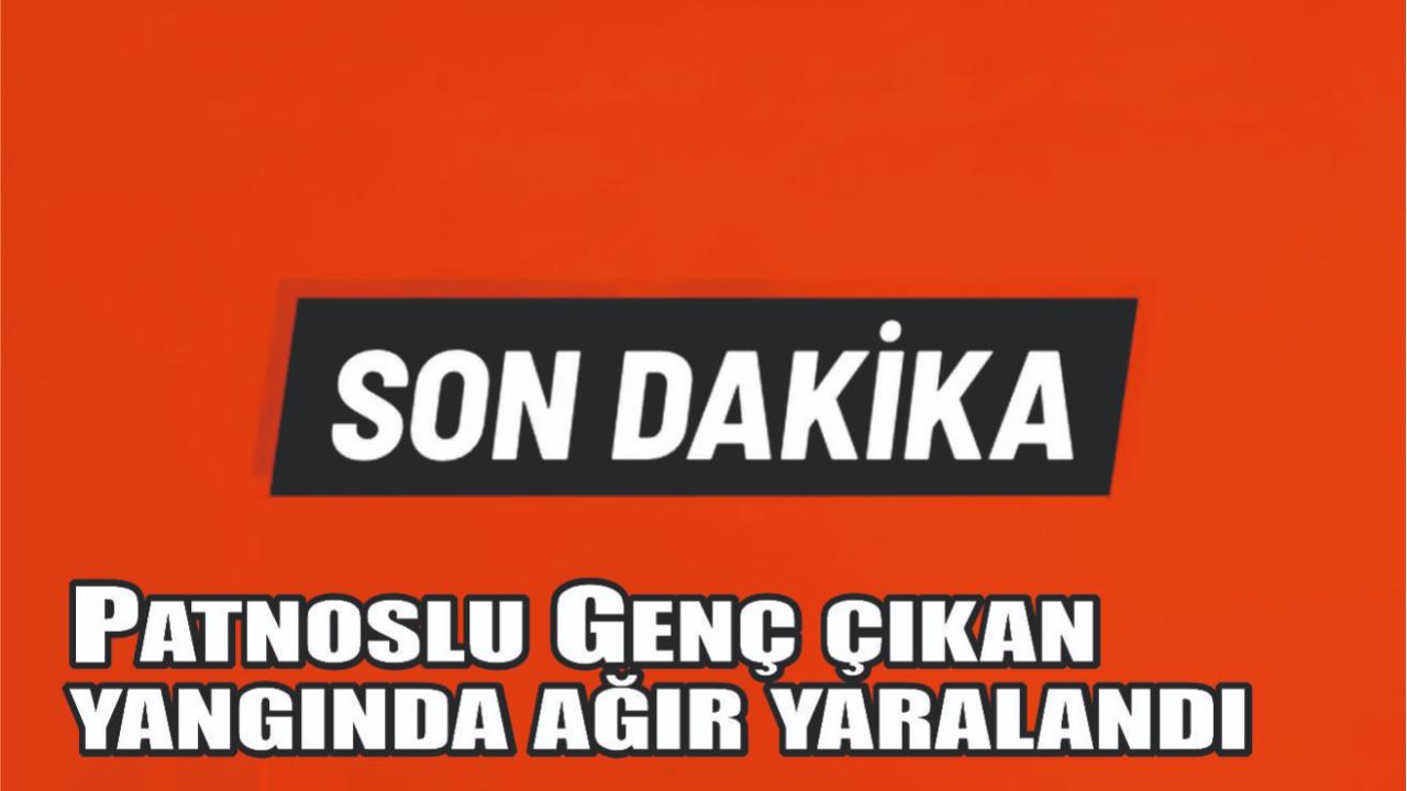 Patnoslu Genç, İnşaat Yangınında Ağır Yaralandı