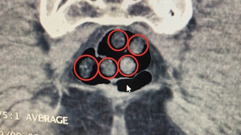 Bitlis’te uyuşturucu operasyonu, 3 kişi tutuklandı