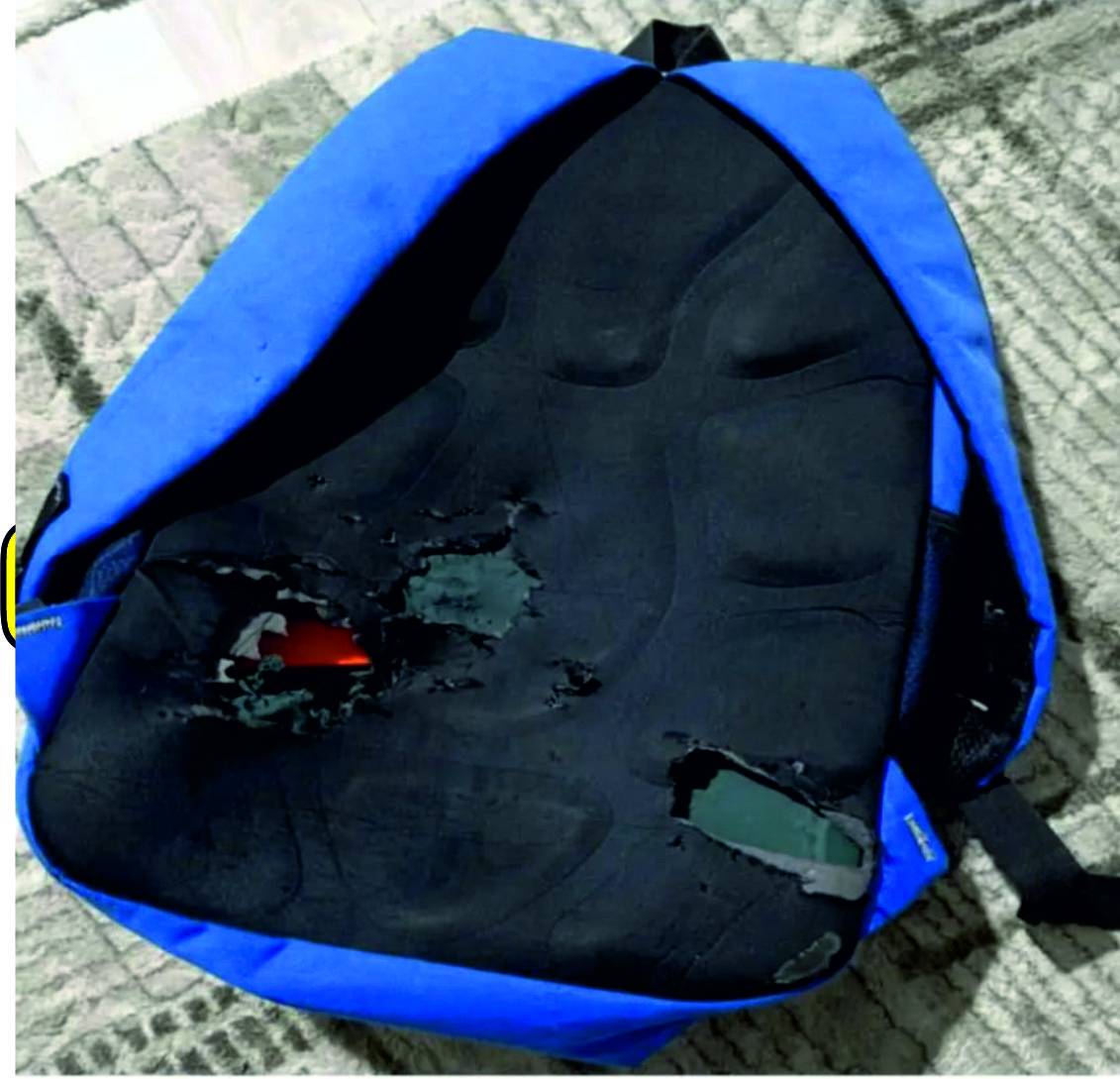 Ağrı’da Sokak Hayvanlarının Saldırısına Uğrayan Öğrenci Korku Dolu Anlar Yaşadı