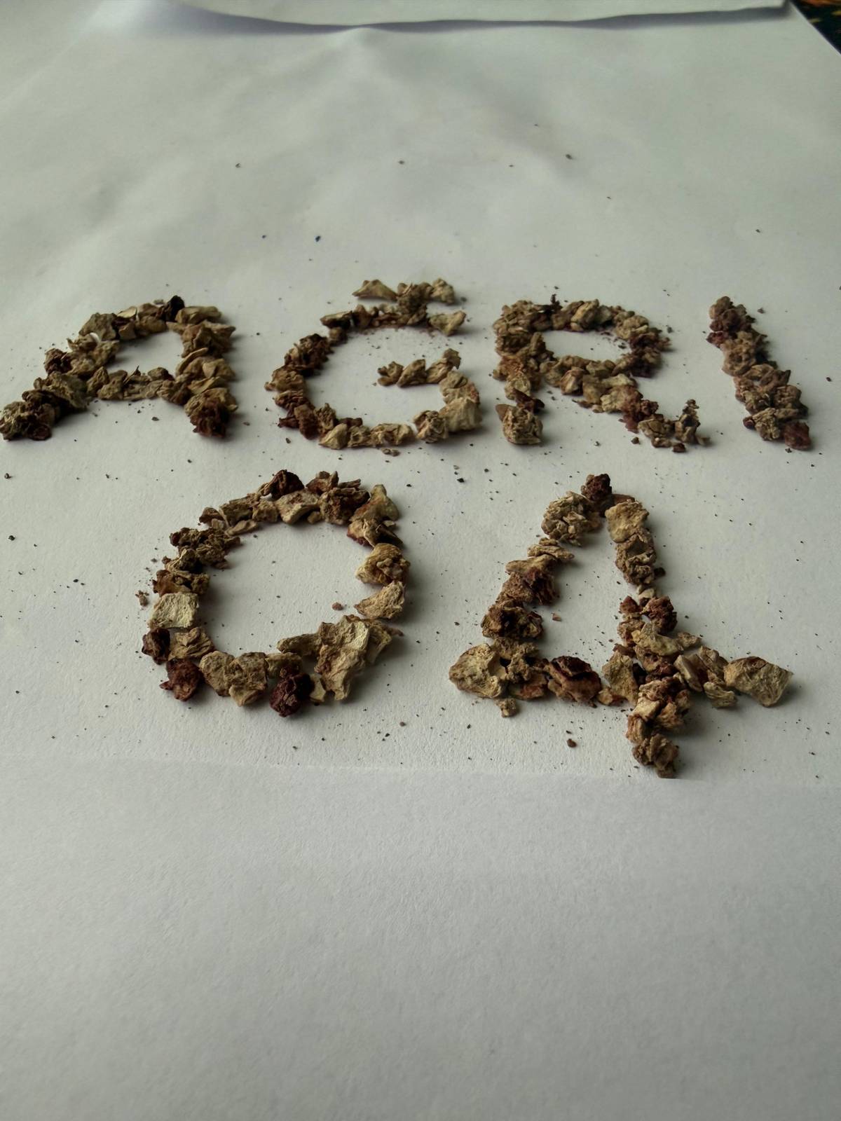 Ağrı’da Üroloji Ekibinden Zorlu Taş Operasyonunda Büyük Başarı