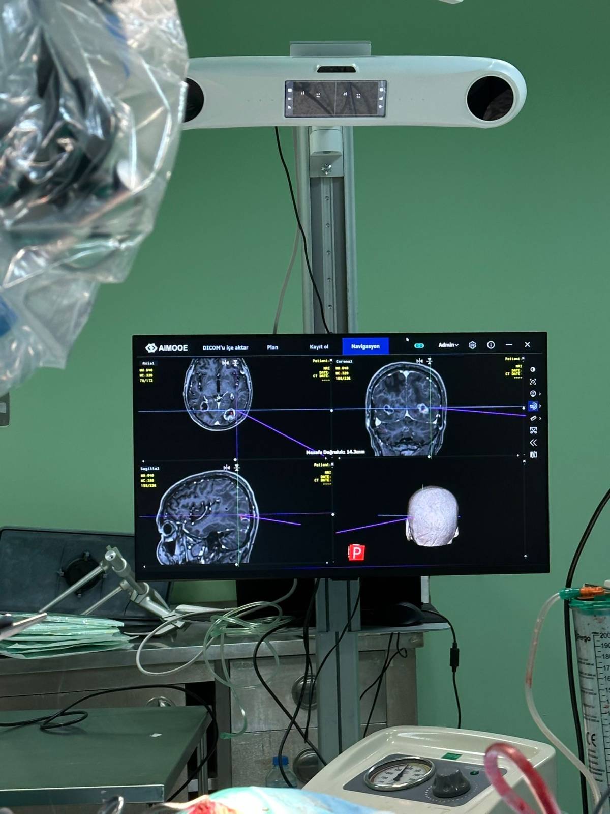 Ağrı’da bir haftada 3 beyin tümörü ameliyatı başarıyla yapıldı